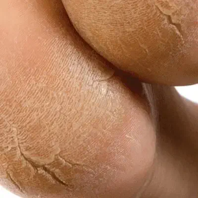 مدل اسپای پاوژلیش|خدمات آرایشگری و زیبایی|بندرعباس, |دیوار