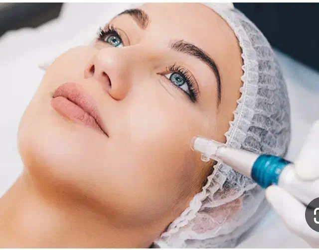 میکرونیدلینگ معجزه جوانسازی|خدمات آرایشگری و زیبایی|صدرا-فارس, فاز ۲|دیوار