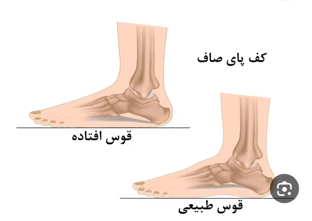 کلینیک تخصصی بهبود کف پای صاف|خدمات آرایشگری و زیبایی|رزن, |دیوار