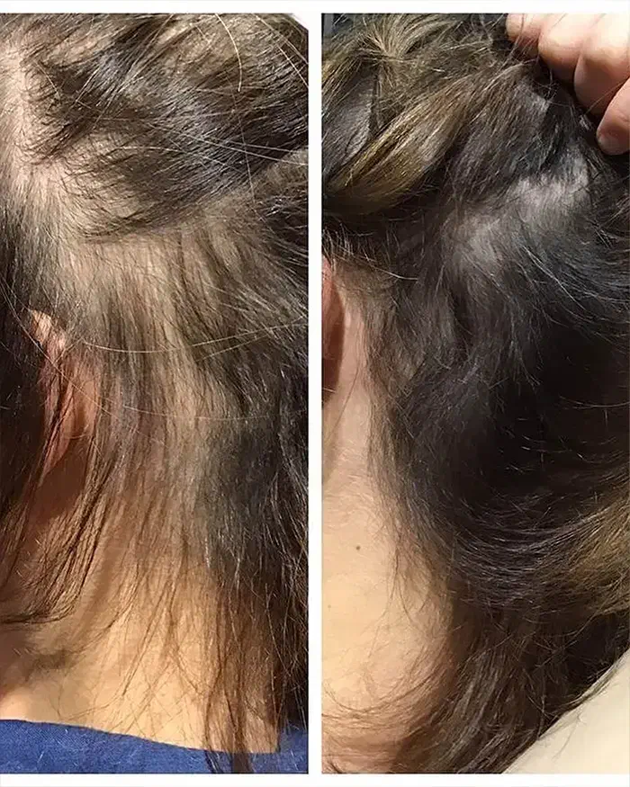 درمان ریزش مو|آرایشی، بهداشتی، درمانی|تهران, جوادیه|دیوار