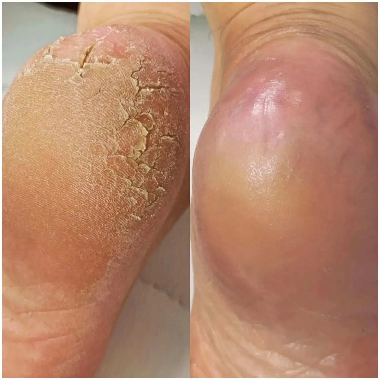 اسپا درمانی کف پا|خدمات آرایشگری و زیبایی|دیلم, |دیوار