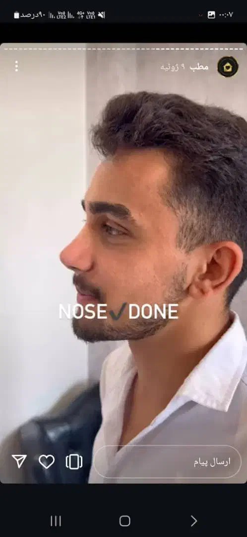 عمل بینی ( فقط ۳۱میلیون)|خدمات آرایشگری و زیبایی|بوئین و میاندشت, |دیوار