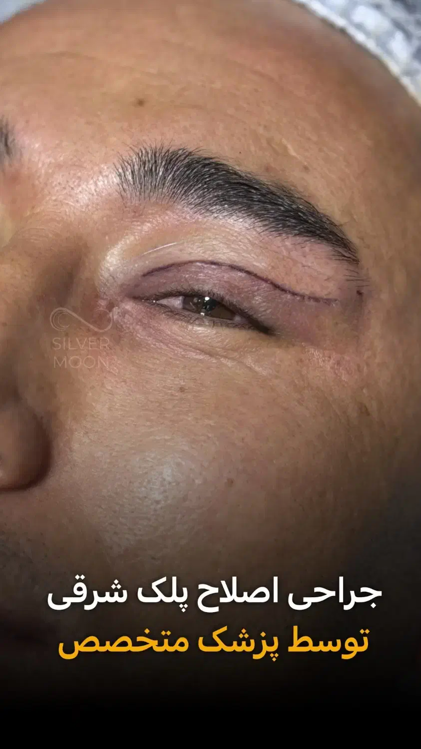 استخدام کلینیک جراحی( پرستارمشاور)|استخدام درمانی، زیبایی، بهداشتی|تهران, قیطریه|دیوار