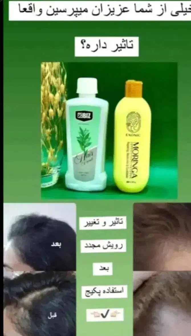 باریزش موهات خداحافظی کنی|آرایشی، بهداشتی، درمانی|گرمسار, |دیوار