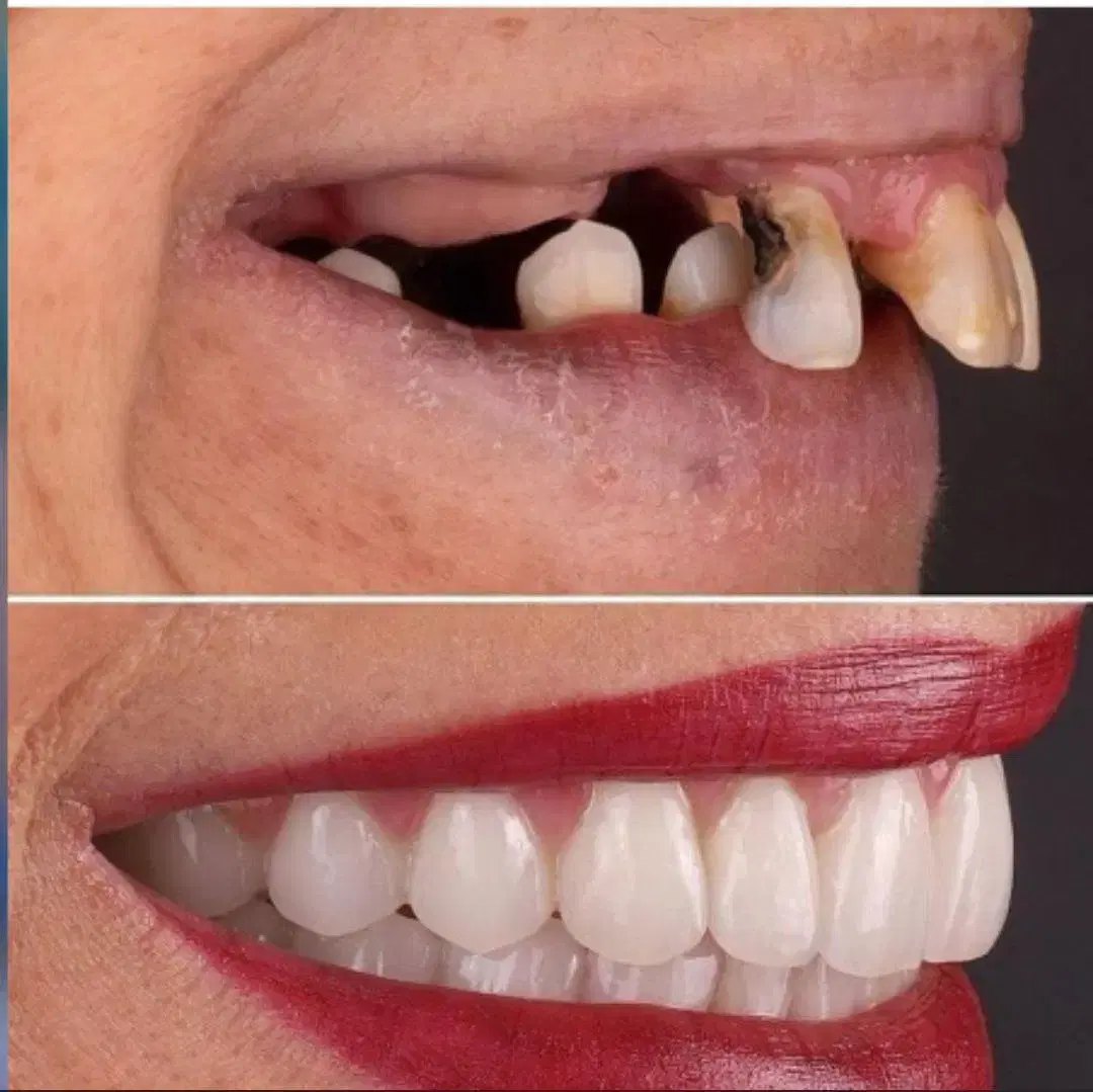 تخصصی ترین مرکز ایمپلنت و دندانپزشکی|خدمات زیبایی و سلامت|تبریز, |دیوار