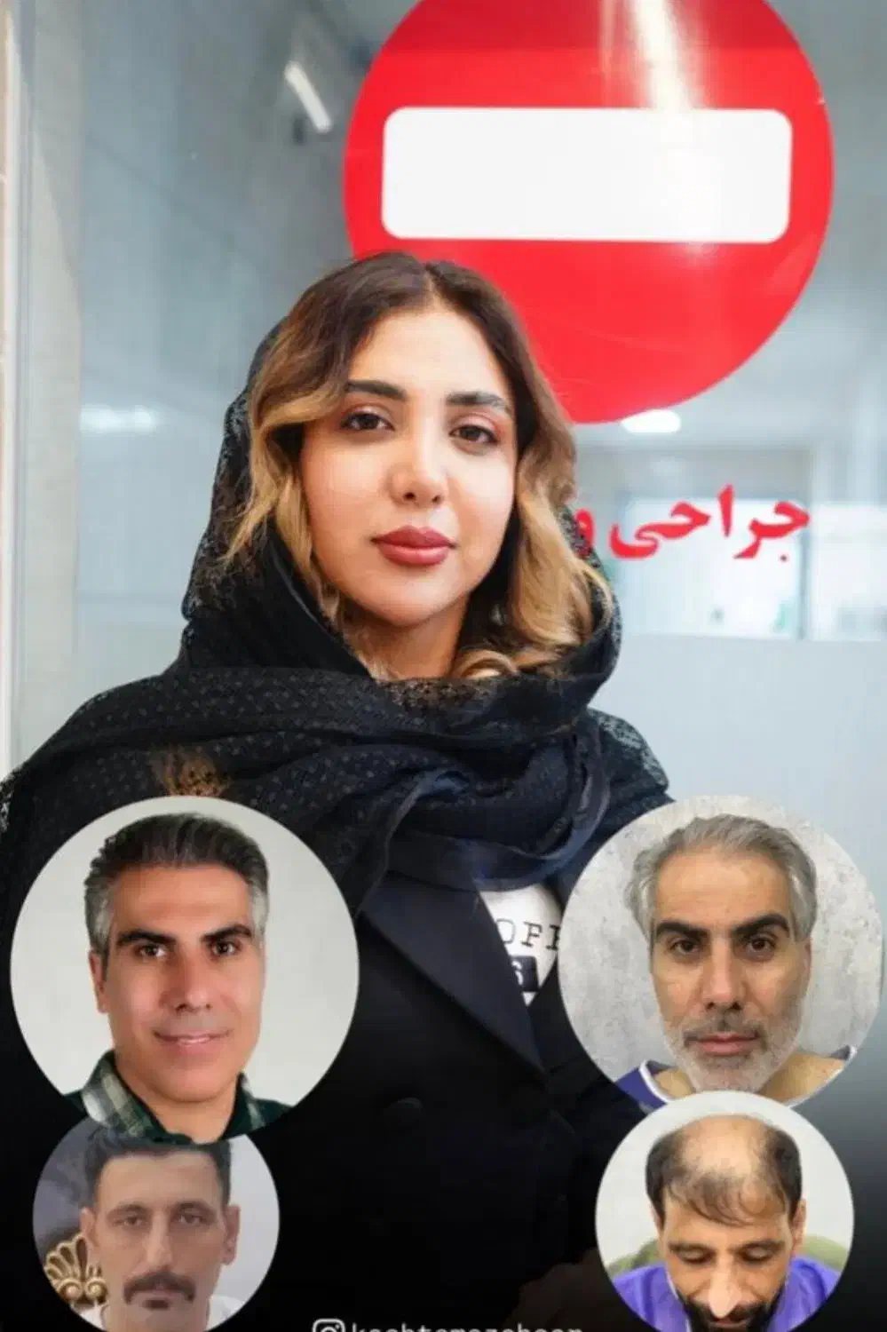 برترین کاشت شقیقه در شیراز|خدمات آرایشگری و زیبایی|شیراز, قصرالدشت|دیوار