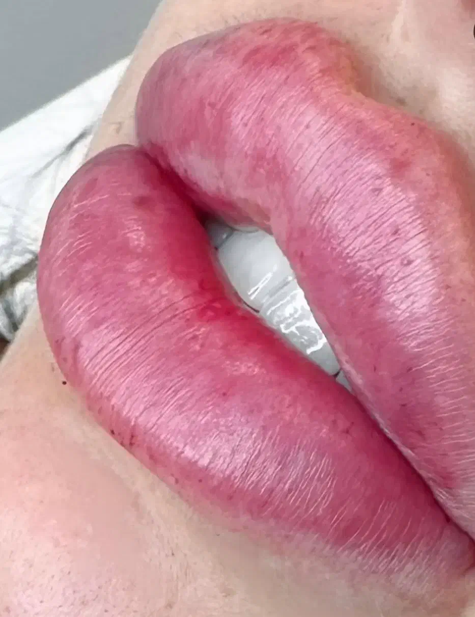 اموزش صفرتاصد فیلروبوتاکس|خدمات آموزشی|فردیس, فردیس|دیوار