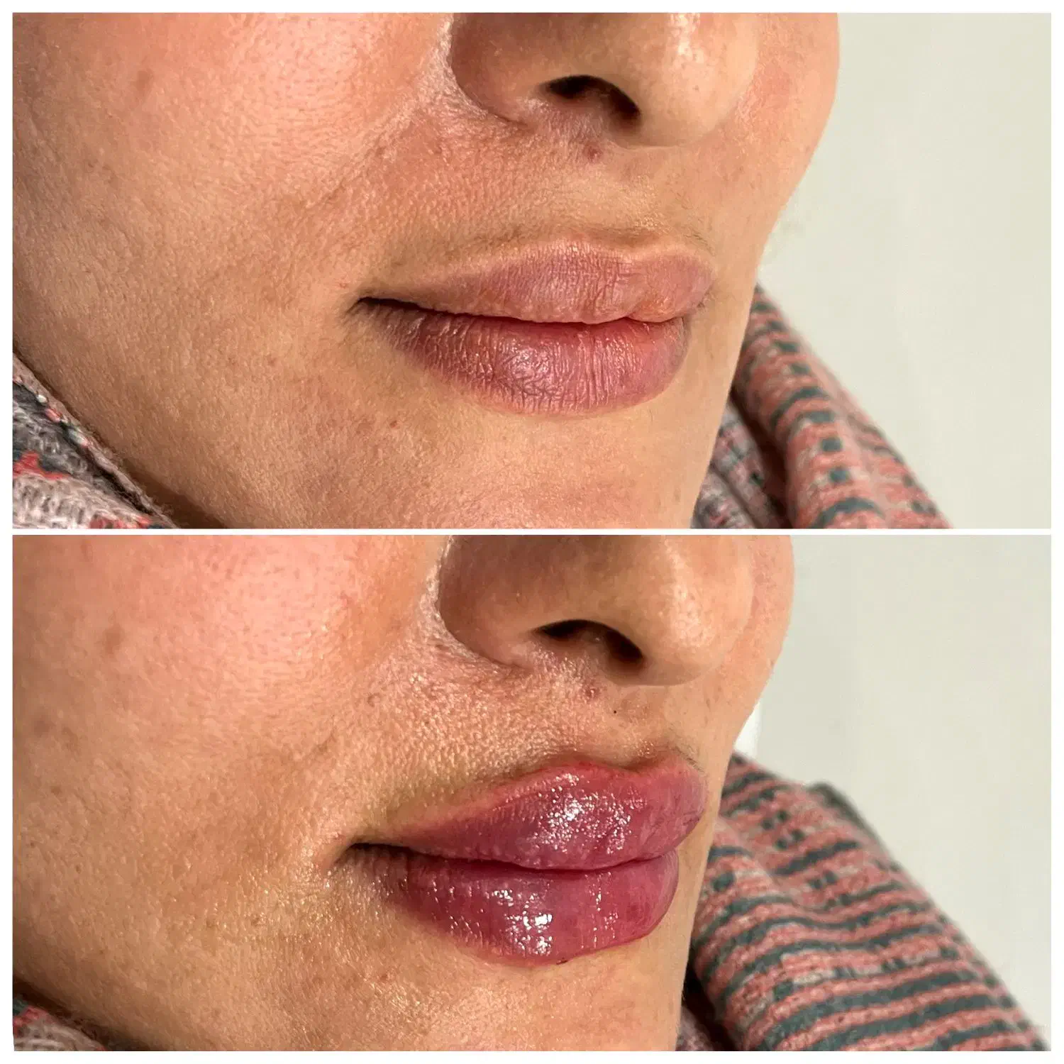 جشنواره بوتاکس مصپورت ۶۵۰فیلر ۶۹۰ فقط تا آخر آبان|خدمات آرایشگری و زیبایی|اصفهان, شمس آباد|دیوار