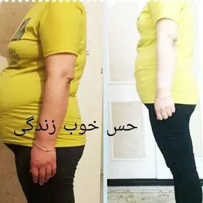 درمان چاقی و لاغری و ماساژ|آرایشی، بهداشتی، درمانی|تبریز, |دیوار