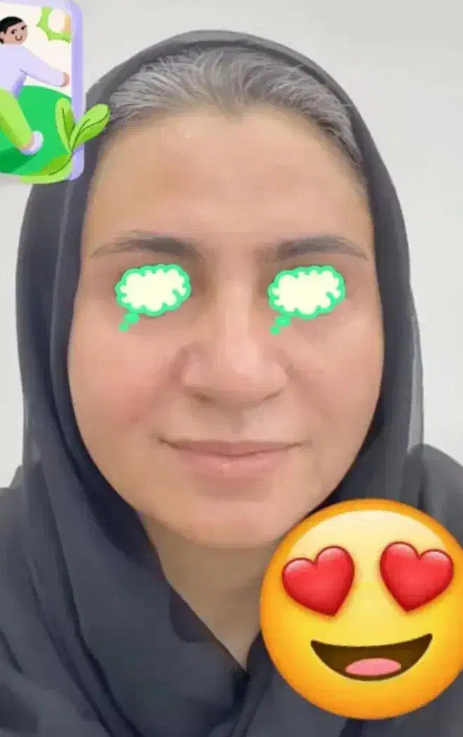 فرمول سفید کننده قوی  تضمینی میدم نتیجه طی سه روز|آرایشی، بهداشتی، درمانی|خاش, |دیوار