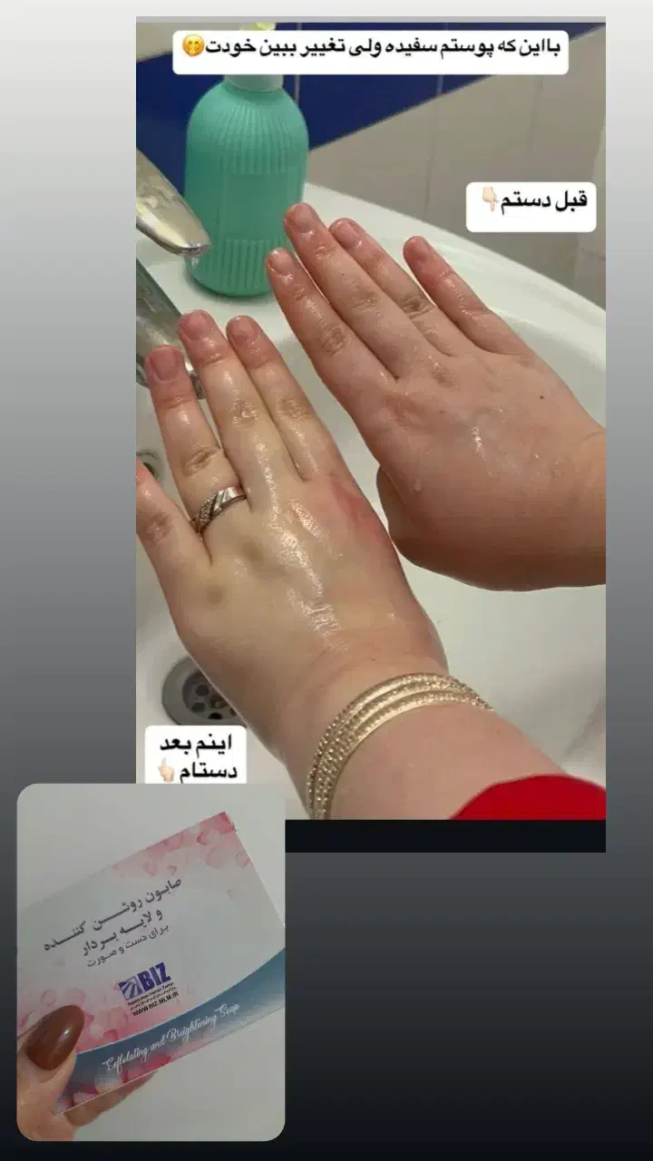 روشن شدن صورت و بدن تضمینی|آرایشی، بهداشتی، درمانی|پارسآباد, |دیوار