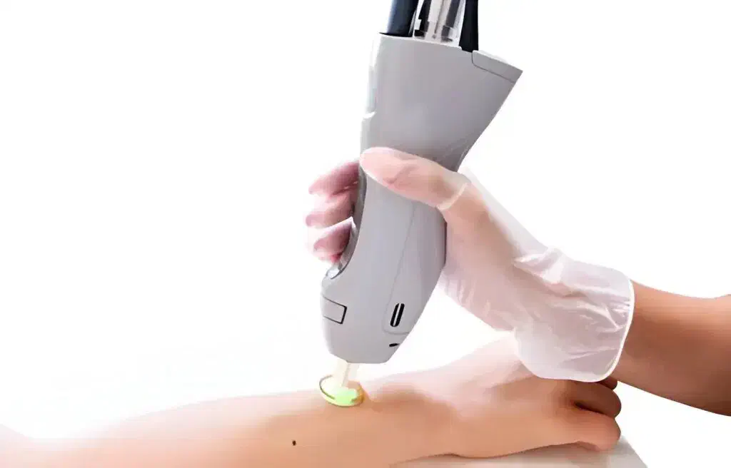 همکاری با اپراتور لیزر بصورت درصدی|استخدام درمانی، زیبایی، بهداشتی|رشت, گلسار|دیوار