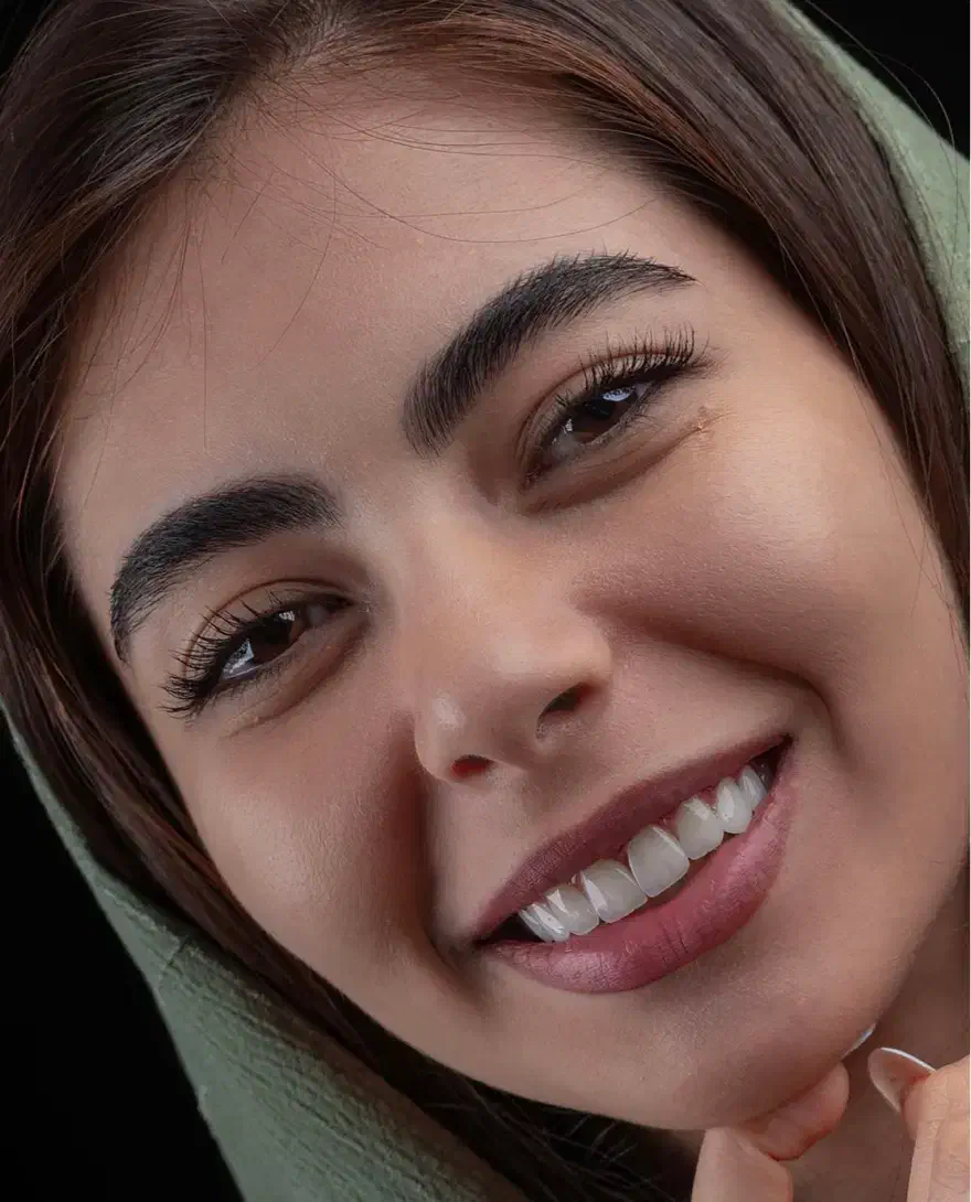 کامبوزیت زیبایی کامپوزیت دندان ضمانت ۵ ساله|خدمات آرایشگری و زیبایی|نهاوند, |دیوار