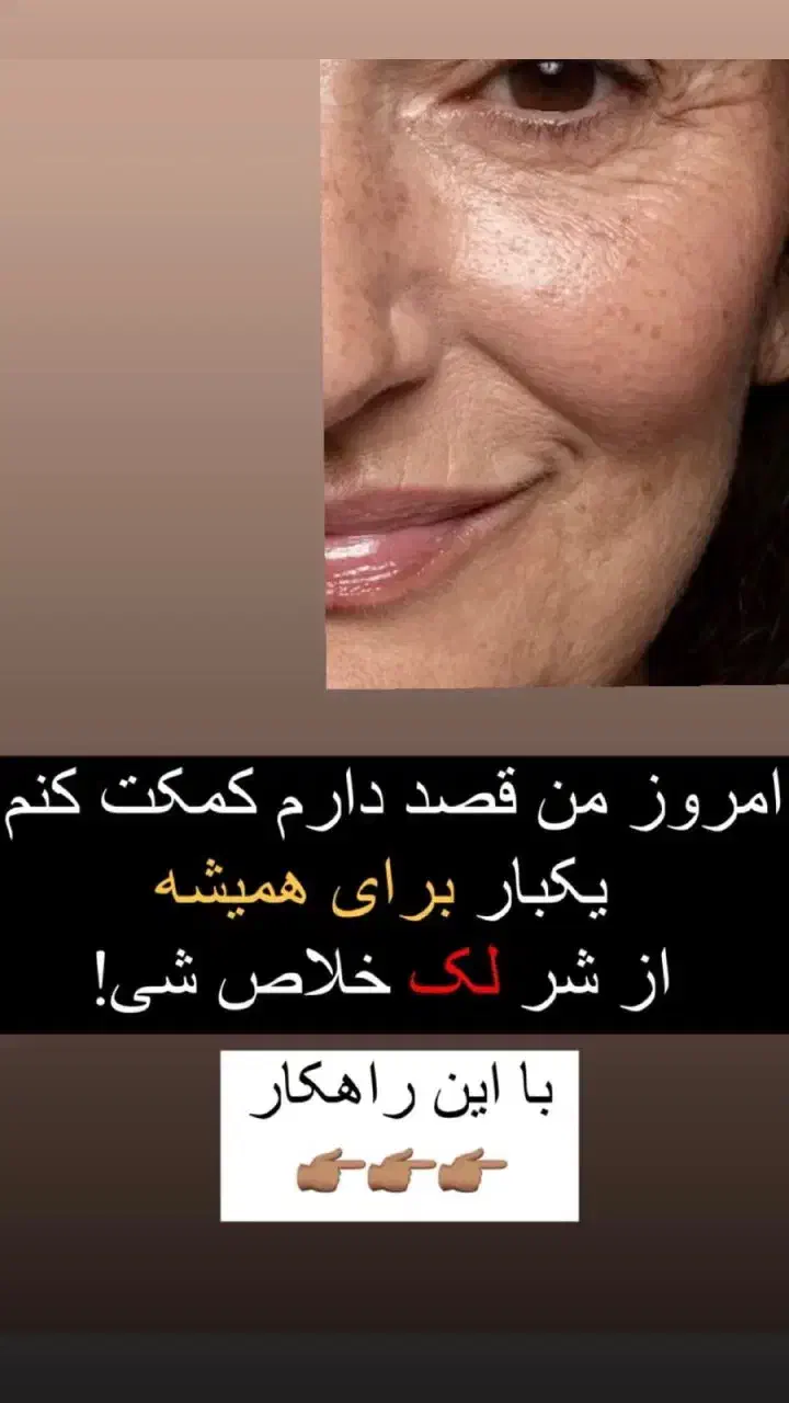 کرم ضد لک لاکچری کویین|آرایشی، بهداشتی، درمانی|بوئین زهرا, |دیوار