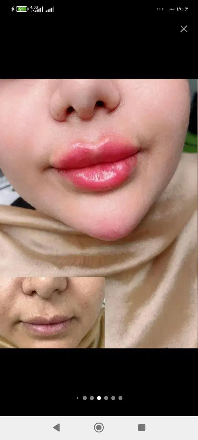 اموزش ژل|خدمات آموزشی|خرم‌آباد, |دیوار