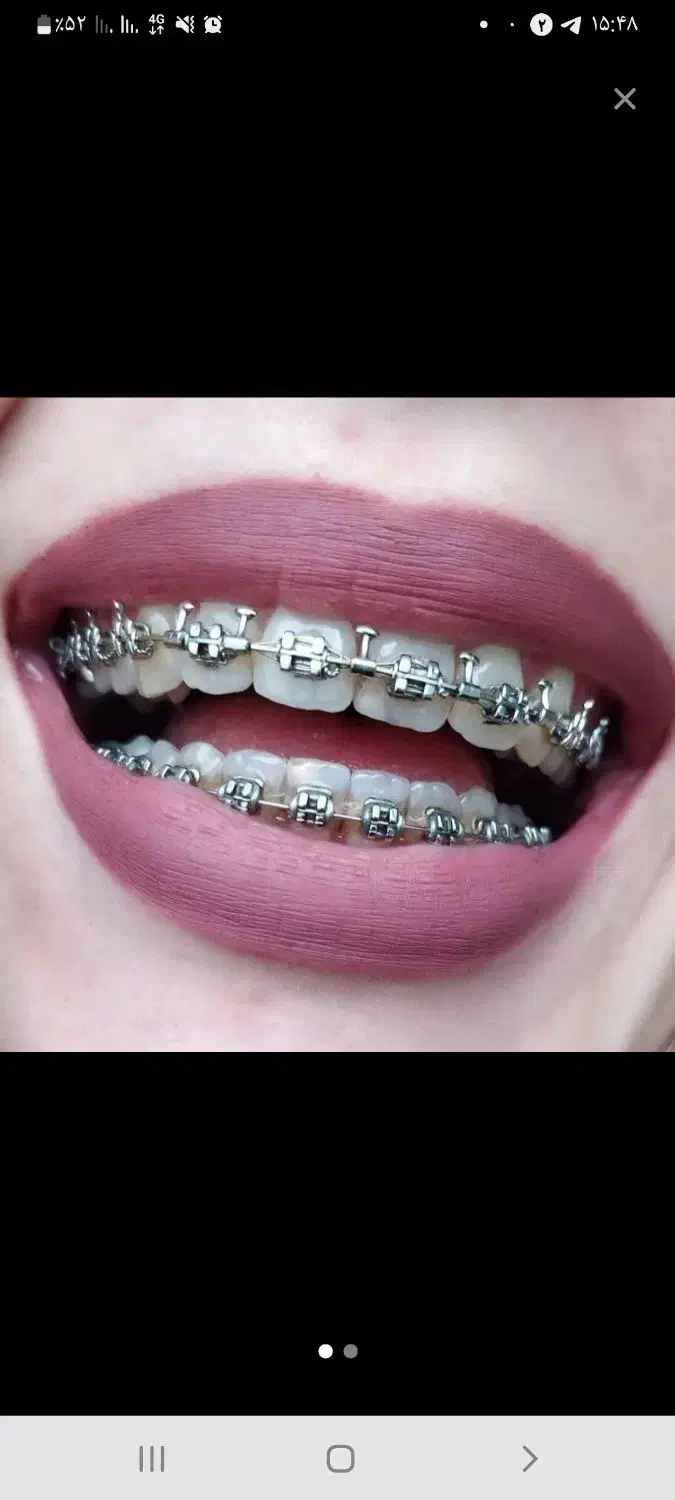 دندون پزشکی|پزشکی|یاسوج, |دیوار