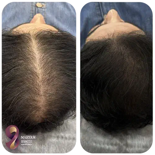 کلینیک تخصصی پوست و مولیزر اسکالپ فیشال بوتاکس ژل|خدمات آرایشگری و زیبایی|یزد, |دیوار