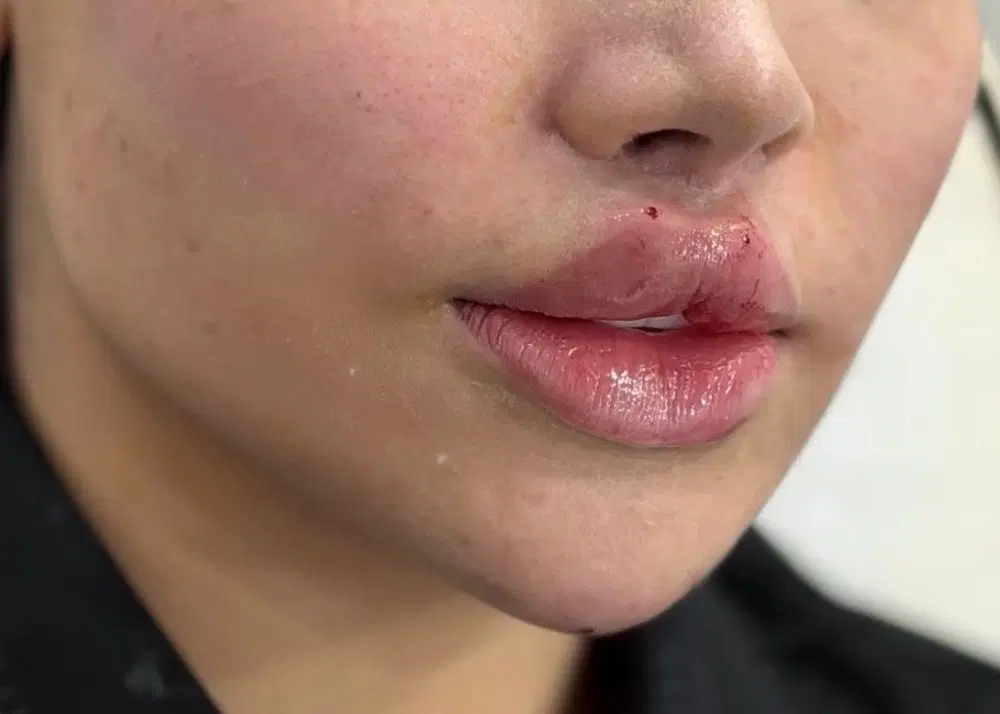 جشنواره 2روزه ژل وبوتاکس آنزیم ومزو|خدمات زیبایی و سلامت|مشهد, طلاب|دیوار