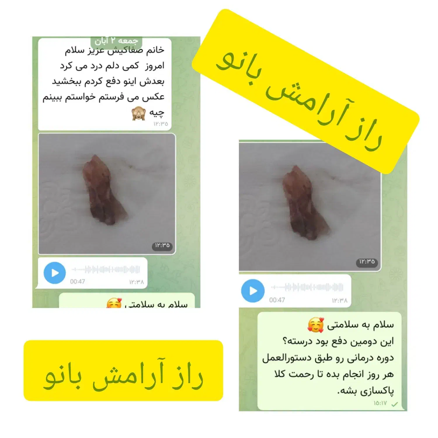 بارداری شیرین بعداز پاکسازی|خدمات آرایشگری و زیبایی|کوهدشت, |دیوار