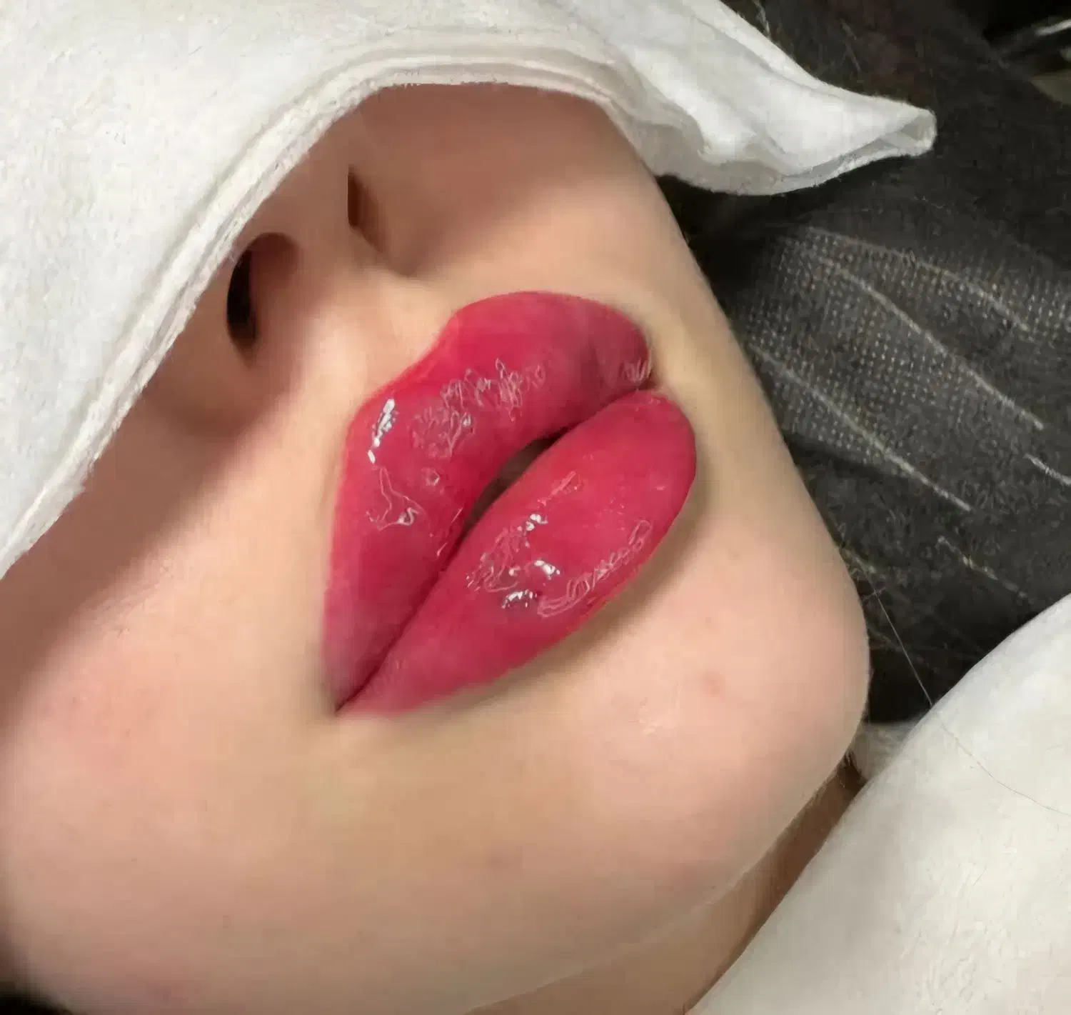 تزریق ژل و بوتاکس در کلینیک زیبایی|خدمات آرایشگری و زیبایی|کرمانشاه, |دیوار