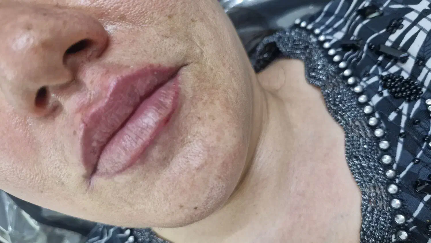 ژل وبوتاکس|خدمات آرایشگری و زیبایی|مشهد, ایثارگران|دیوار