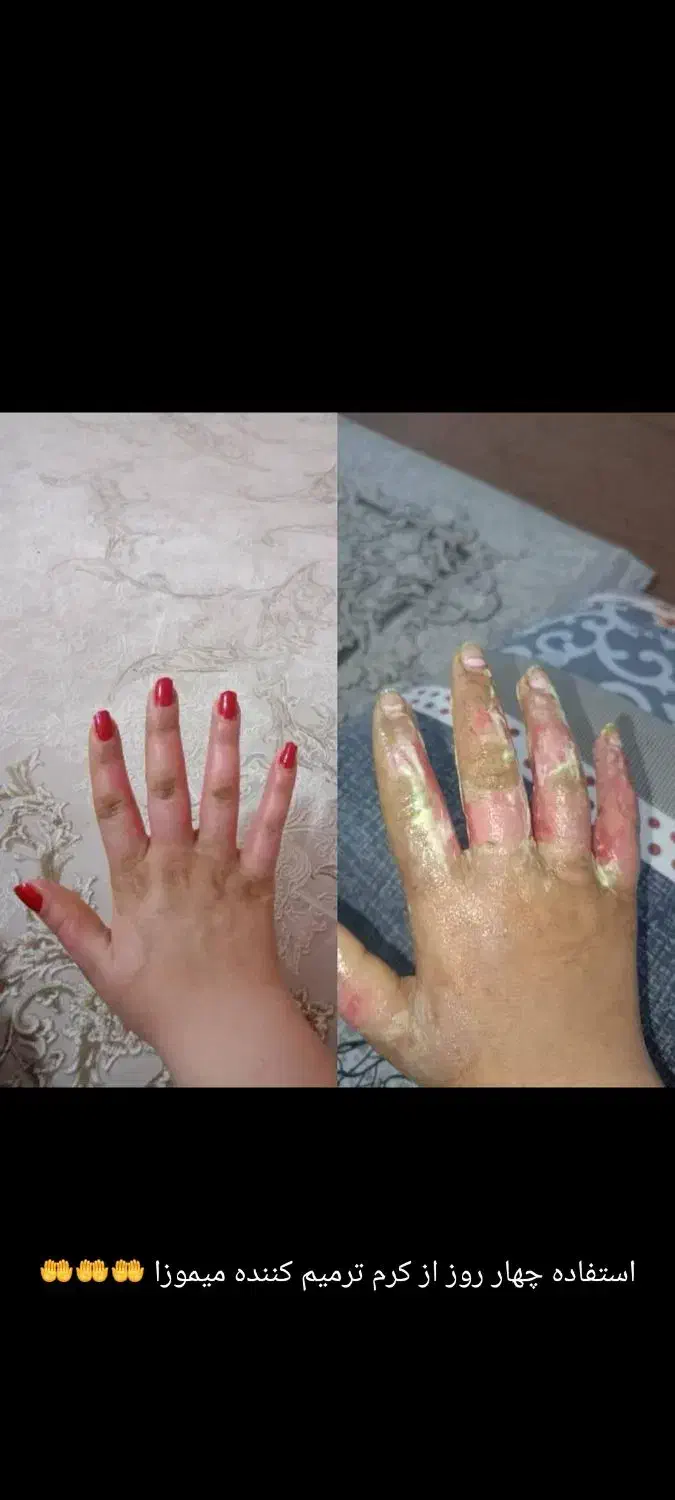 محصولات مراقبتی پوست و مو و سلامت بدن|آرایشی، بهداشتی، درمانی|خوی, |دیوار