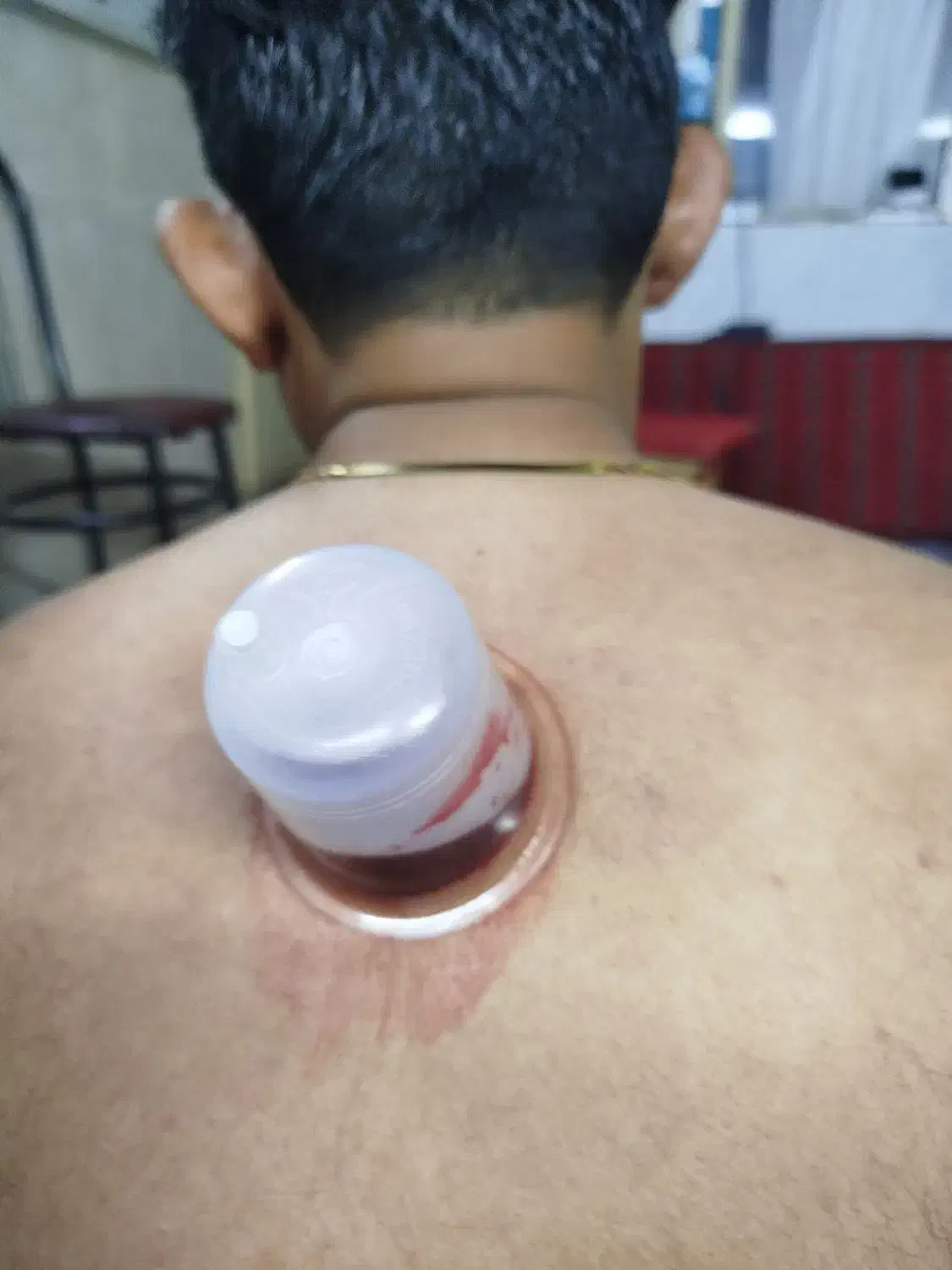 زالو درمانی و حجامت درطب سنتی با ۸ سال سابقه کار|خدمات آرایشگری و زیبایی|سبزوار, شرق کال میانی|دیوار