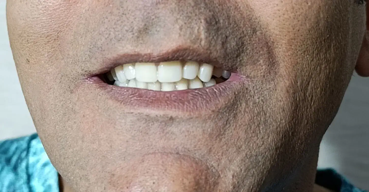 لابراتوار لبخند زیبا مبلغ ۱۵ میلیون و چک صیادی|خدمات آرایشگری و زیبایی|آباده, |دیوار