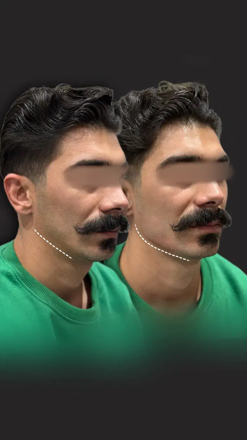 خدمات زیبایی|خدمات آرایشگری و زیبایی|زنجان, |دیوار