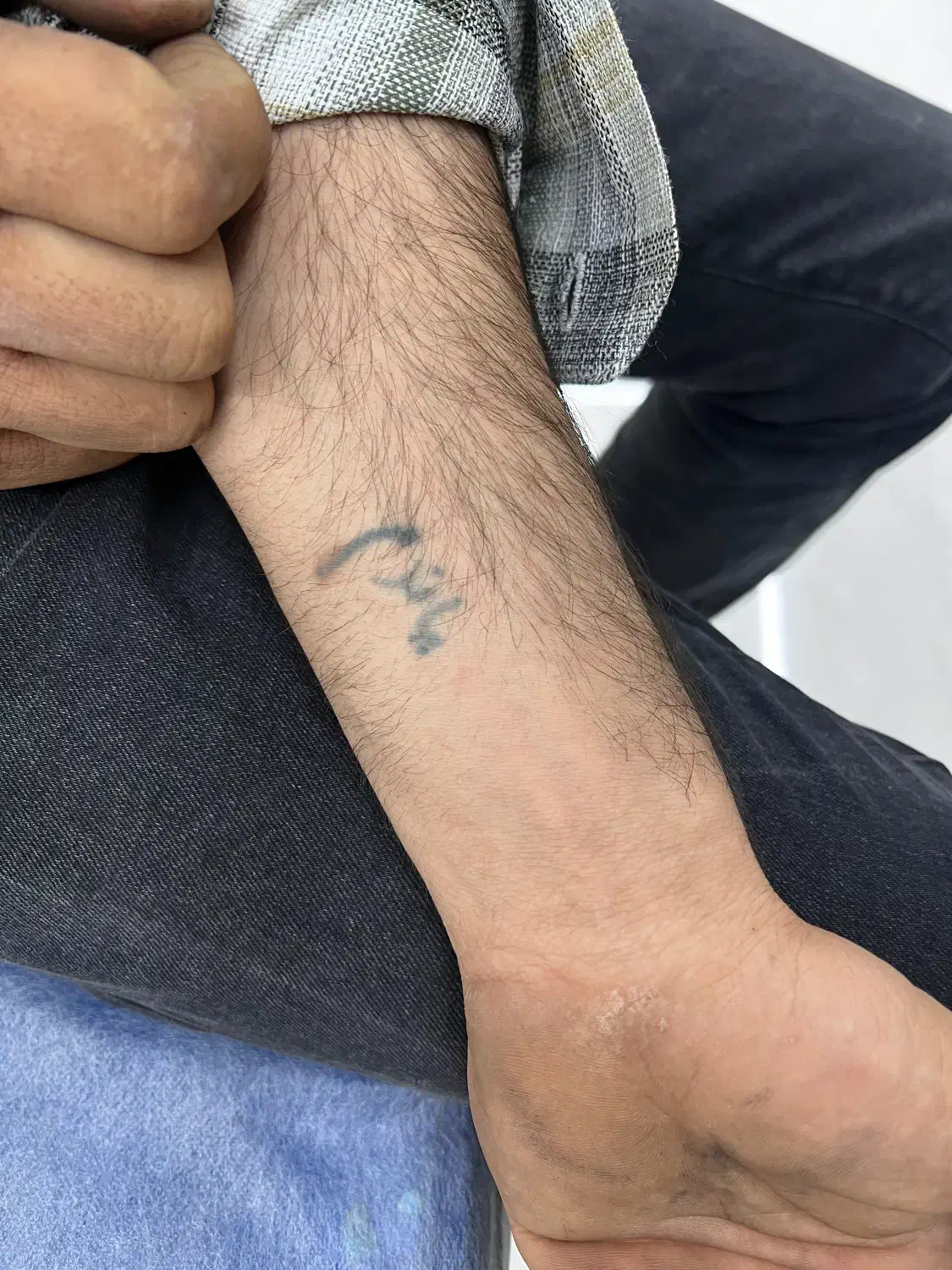 لیزر تتو وروشن کننده بدن|خدمات آرایشگری و زیبایی|پاکدشت, پاکدشت (مامازند)|دیوار