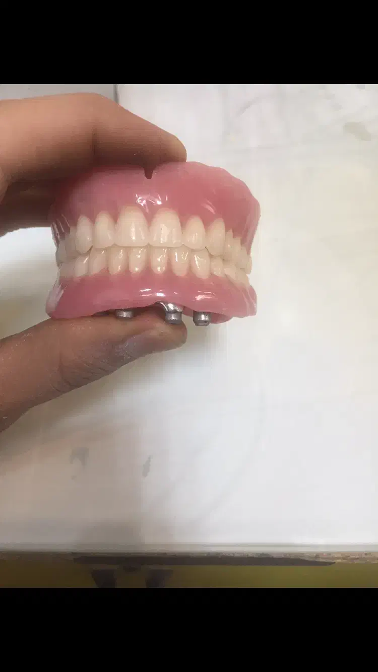 ساخت انواع دندان مصنوعی|خدمات آرایشگری و زیبایی|تهران, وحیدیه|دیوار