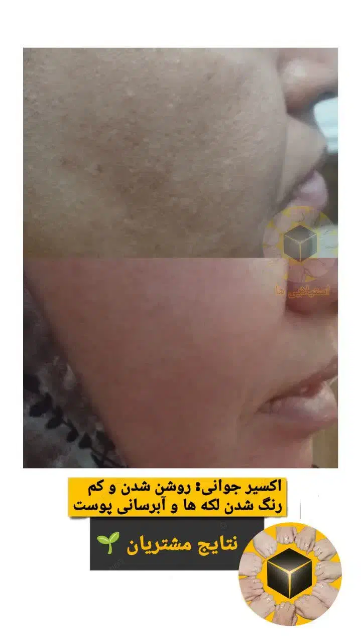 همایش روغن تراپی|گردهمایی و همایش|جهرم, |دیوار