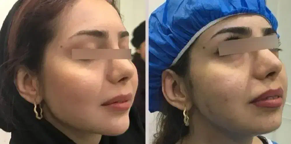 کلینیک پیکرتراشی لیپو،ابدو،پروتز،مامو،تزریق چربی|خدمات آرایشگری و زیبایی|تهران, اقدسیه|دیوار