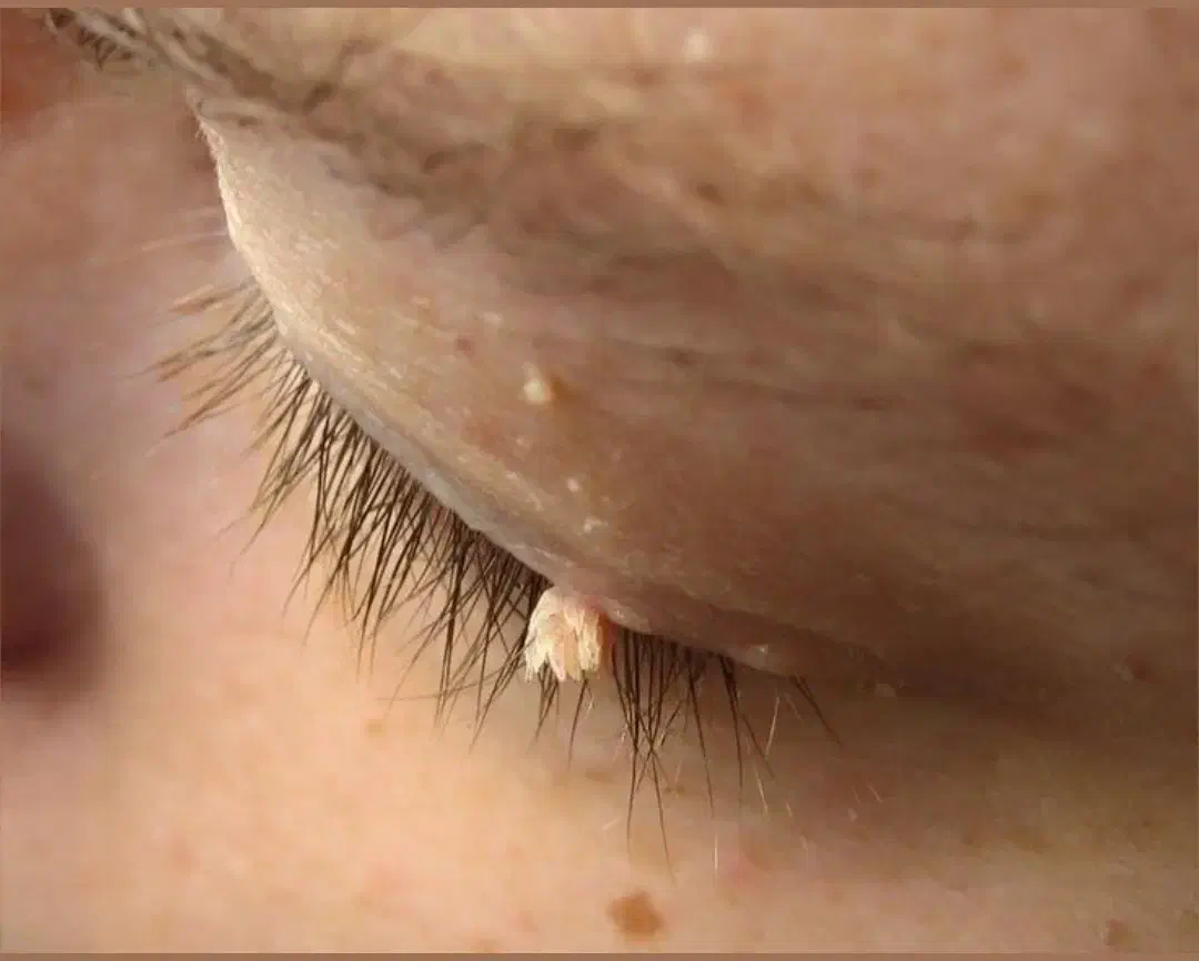 مشاوره تخصصی ویروسهای خاص بدن (مشاوره محرمانه)|آرایشی، بهداشتی، درمانی|گنبد کاووس, |دیوار