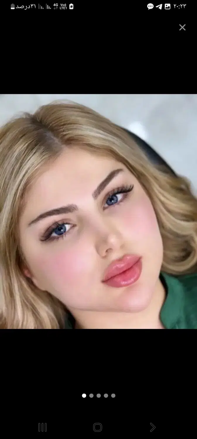 ژل لب بوتاکس نخ آموزش بینی عروسکی مدل رایگان|خدمات زیبایی و سلامت|کرج, گلشهر|دیوار