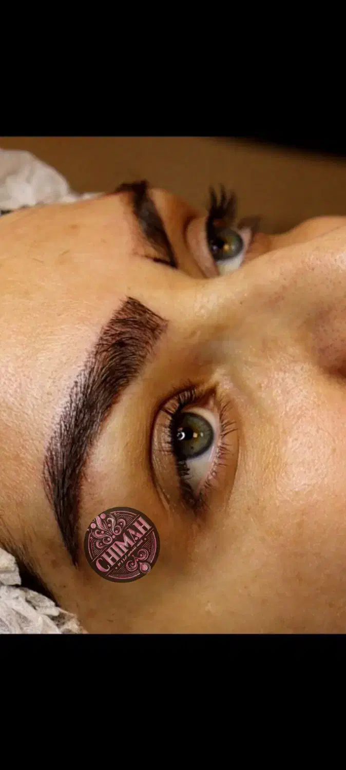 کاشت مو و ابرو باجدیدترین تکنیک های کاشت در لرستان|خدمات آرایشگری و زیبایی|خرمآباد, |دیوار