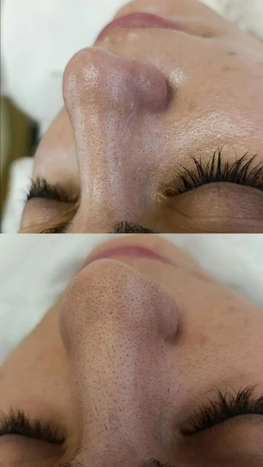 آموزش پاکسازی پوست فیشیال فیشال|خدمات آموزشی|کرمانشاه, |دیوار
