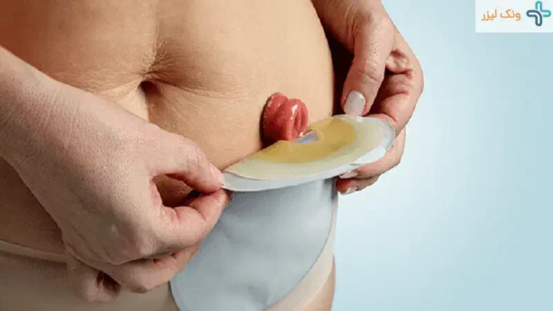 پرستار تخصصی مراقبت از استومی|خدمات آرایشگری و زیبایی|تهران, امیرآباد|دیوار