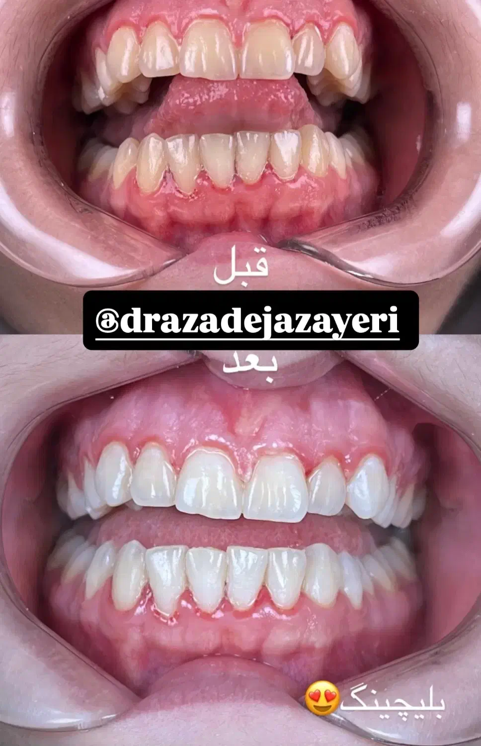 تخفیف خدمات دندانپزشکی|خدمات آرایشگری و زیبایی|رشت, گلسار|دیوار