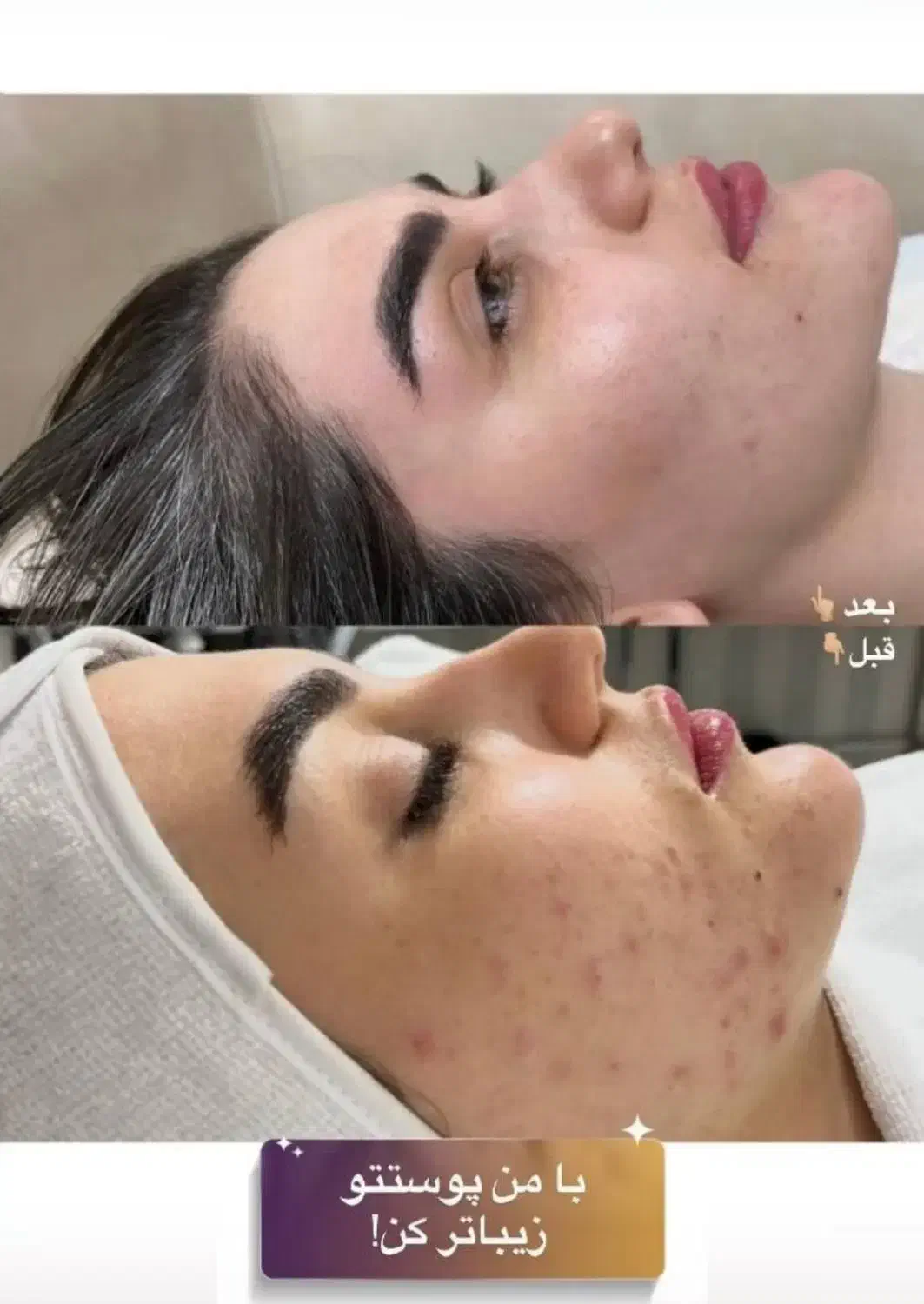 فیشال پوست و کاشت ناخن تضمینی تخفیف یلدایی|خدمات آرایشگری و زیبایی|فردیس, فردیس|دیوار