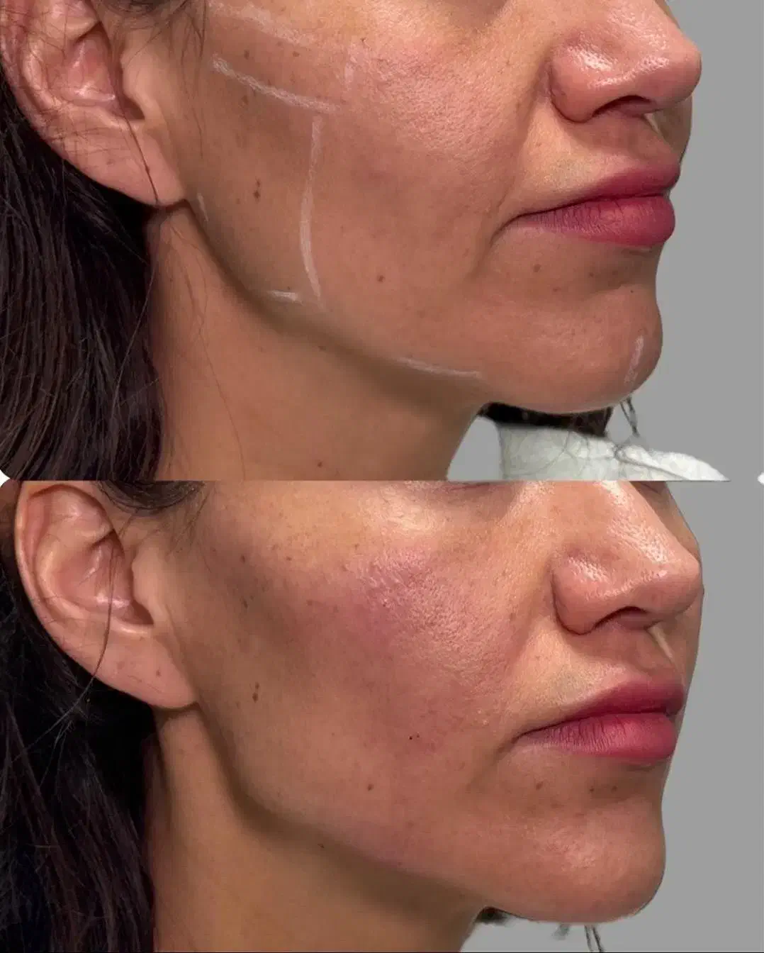 آموزش تخصصی تزریقات زیبایی و لیزر|خدمات آموزشی|اندیشه, اندیشه فاز ۱|دیوار