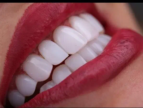 دندانسازی تخصصی دنیز|خدمات آرایشگری و زیبایی|زنجان, |دیوار