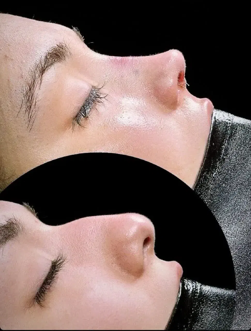 جشنواره جراحی و عمل بینی در کرج و تهران|خدمات آرایشگری و زیبایی|کرج, عظیمیه|دیوار