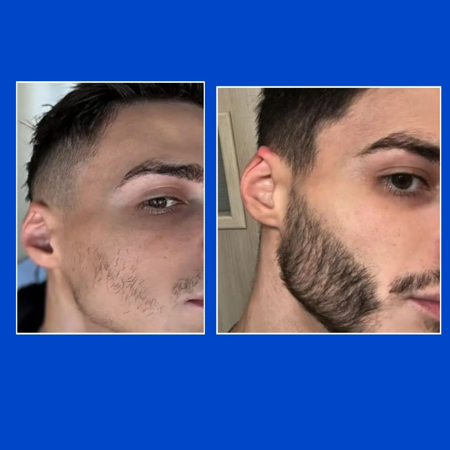 مو پوست|آرایشی، بهداشتی، درمانی|ساری, |دیوار
