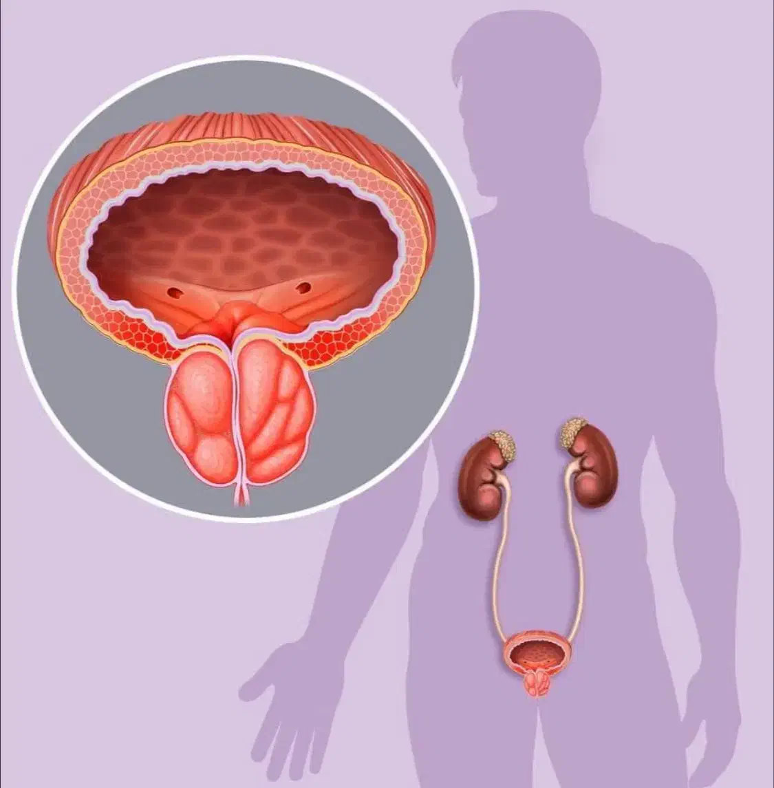 «مشـ ـکلات آقایان درمـ ـان شـ ـد»|خدمات آرایشگری و زیبایی|خرمدره, |دیوار