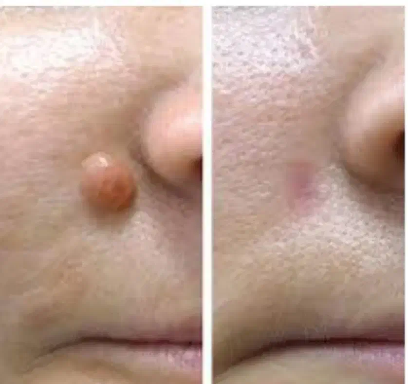 خالبرداری تخصصی فیلربوتاکس پی ارپی مزوتراپی|خدمات آرایشگری و زیبایی|کرج, حیدرآباد|دیوار