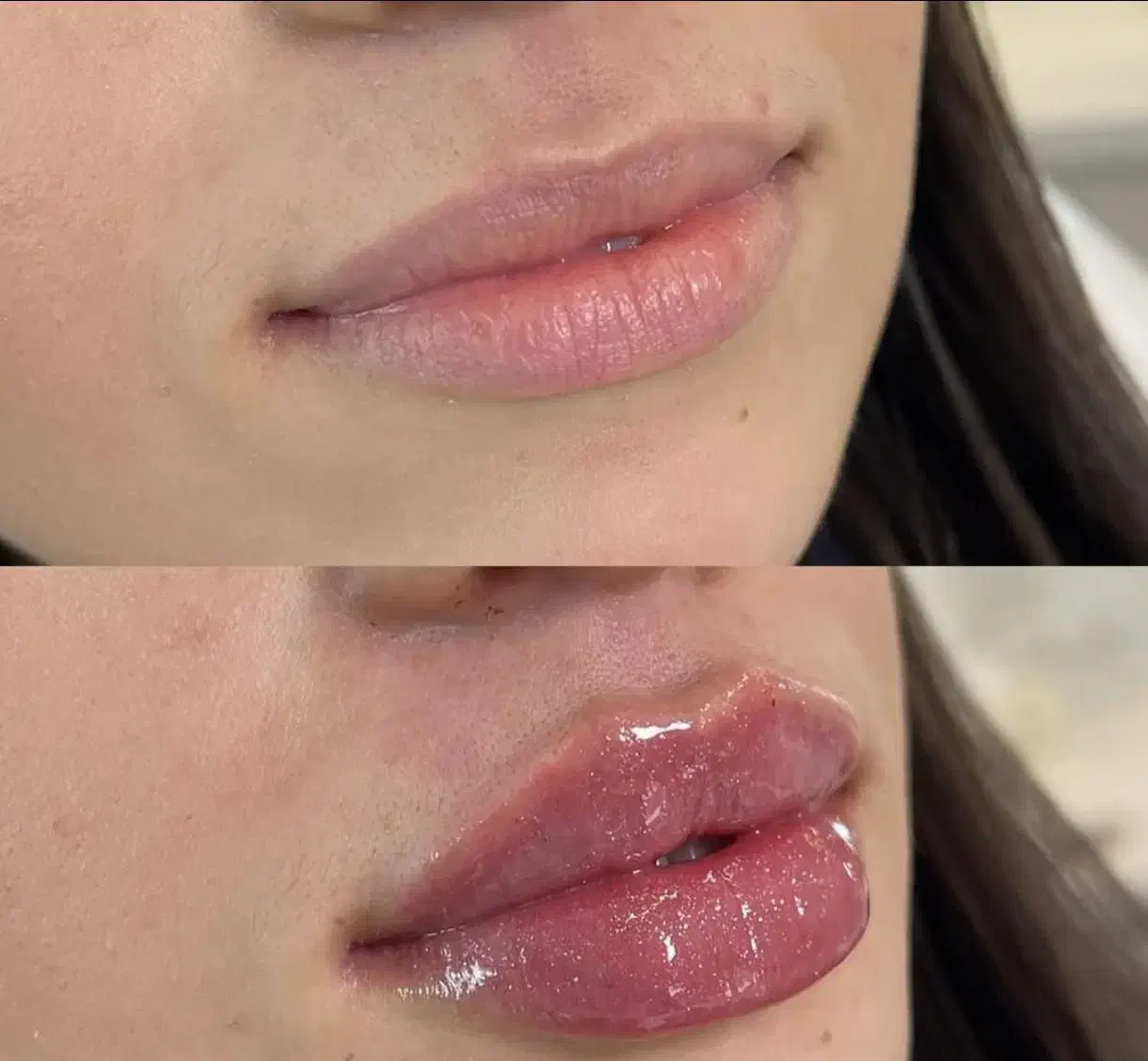 تخصص حرفه ای تزریق لب روسی|خدمات آرایشگری و زیبایی|ارومیه, |دیوار