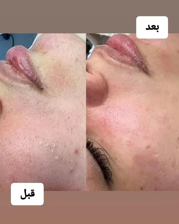 ارائه خدمات زیبایی|خدمات آرایشگری و زیبایی|کرمانشاه, |دیوار