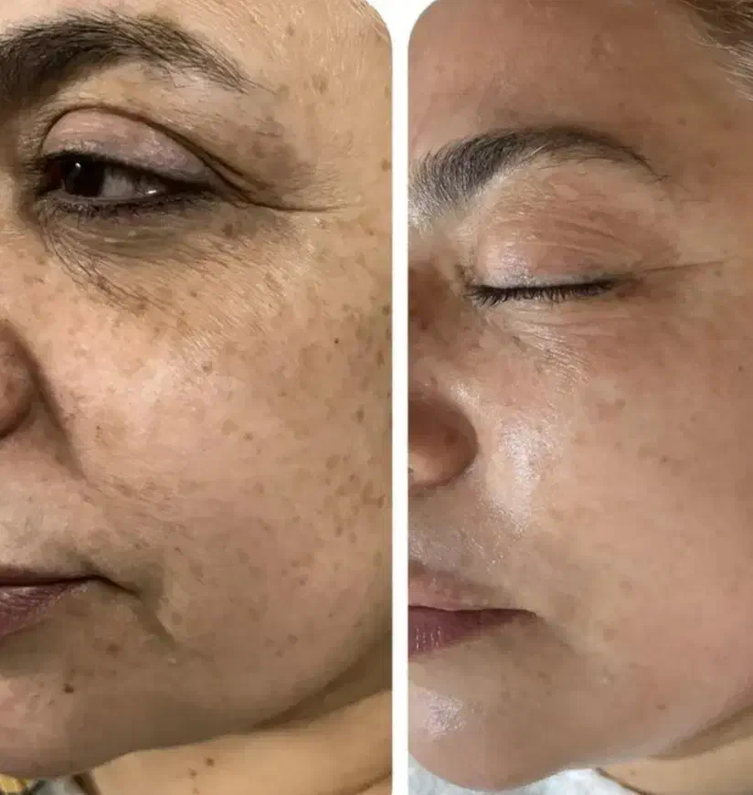 آف و تخفیف ویژه فیشال و پاکسازی آقایان و بانوان|خدمات آرایشگری و زیبایی|ایذه, |دیوار