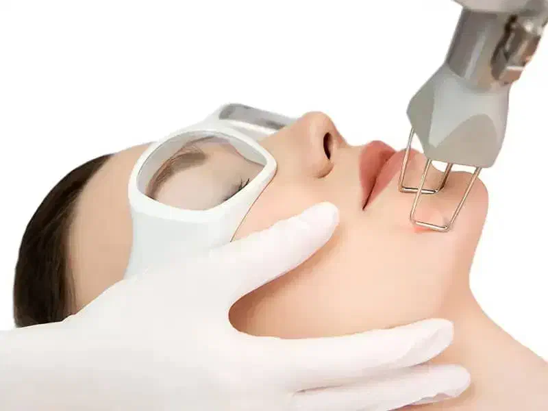 لیزر زیبایی|خدمات آرایشگری و زیبایی|بروجرد, |دیوار